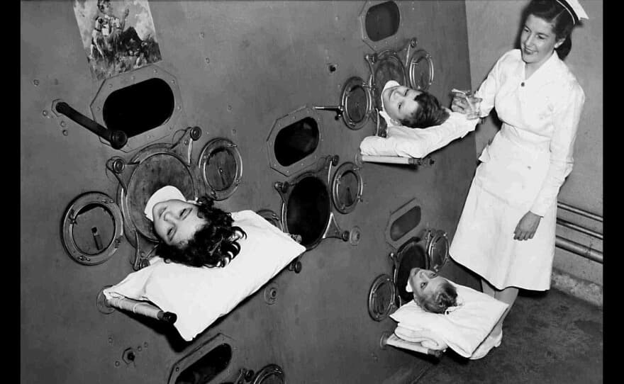Polio Epidemic Peaks